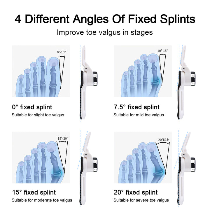 Toe Valgus Correction Orthosis Splint for Men and Women