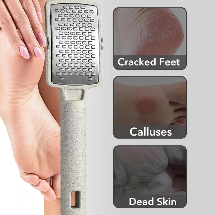 Stainless Steel Foot File Callus Remover with Dead Skin Storage