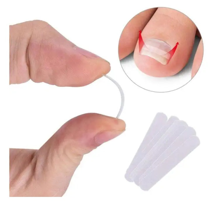 Dedicated Ingrown Nail Orthodontic  Correction Patch Inflammation Manicure Clippers