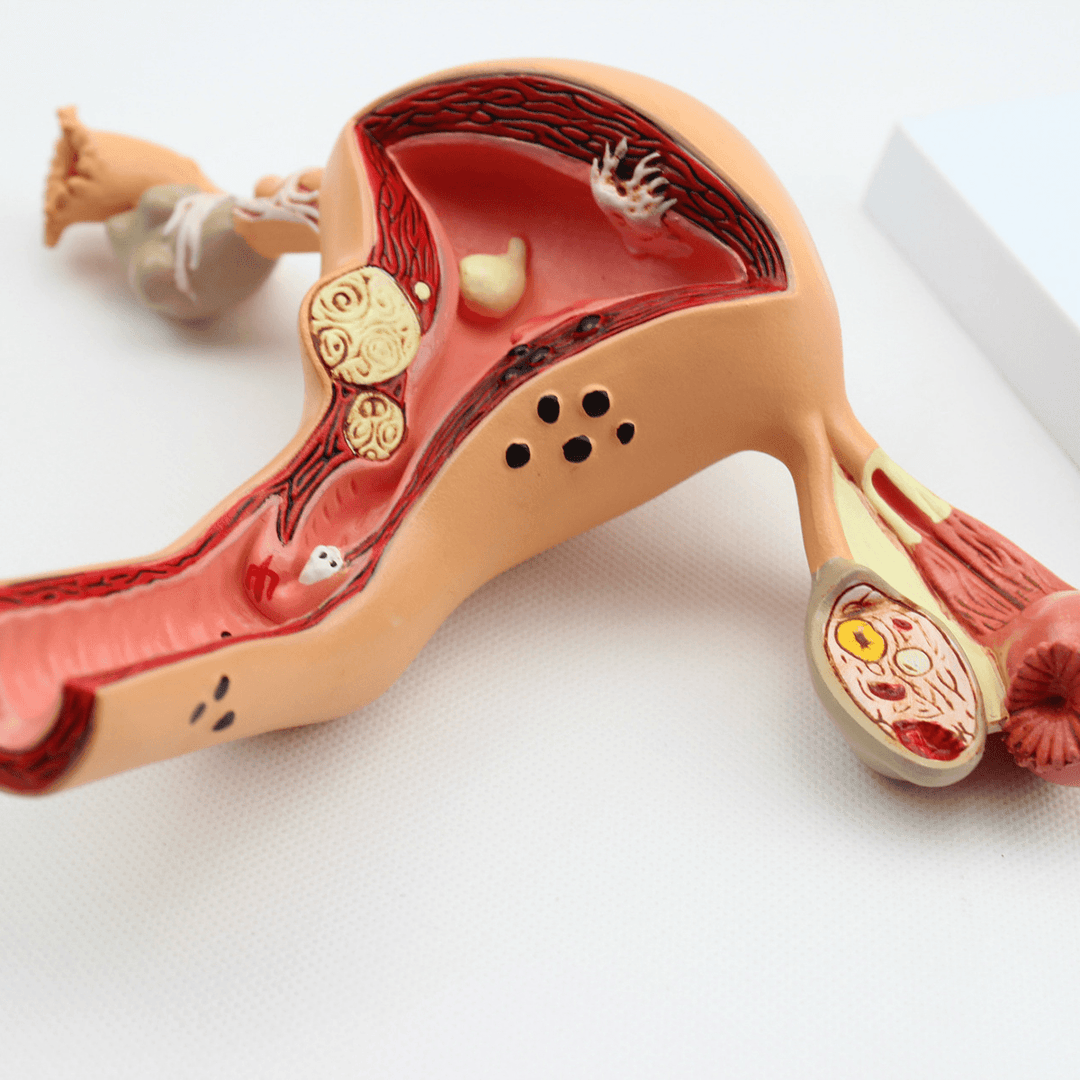 1Pcs Uterus Ovary Anatomical Medical Model Anatomy Cross-Section Science Toy with Base - Trendha